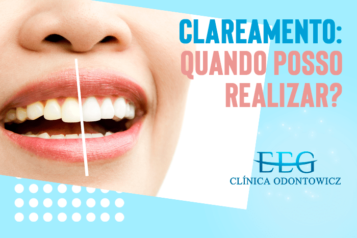 Clareamento: quando posso realizar?