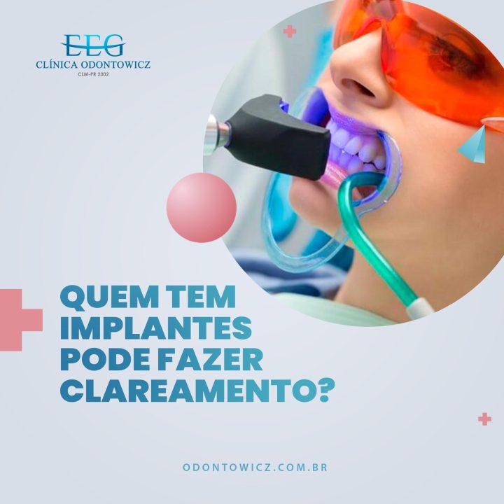 Quem tem implantes pode fazer clareamento?