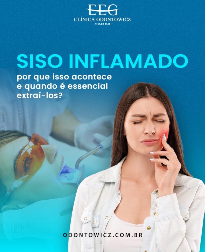 Siso inflamado: por que isso acontece e quando é essencial extraí-los?