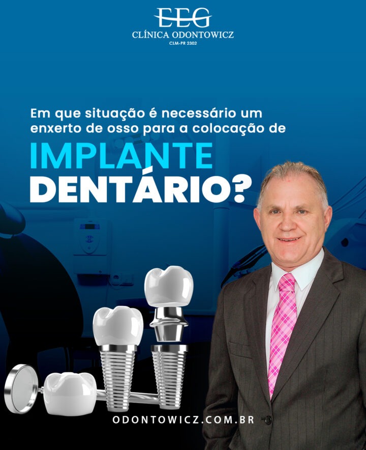 Em que situação é necessário um enxerto de osso para a colocação de implante dentário?