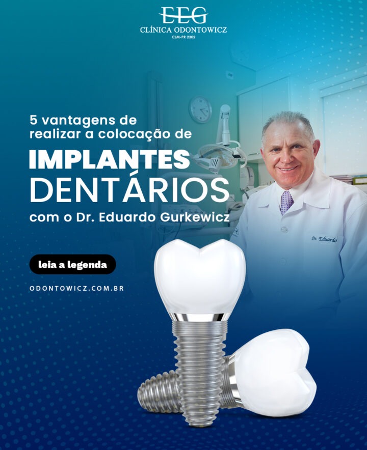 5 vantagens de realizar a colocação de implantes dentários com o Dr. Eduardo Gurkewicz